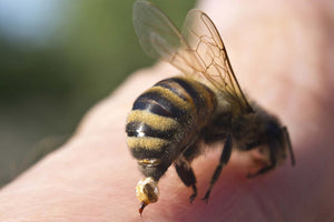 Bee stings VS Wasp stings